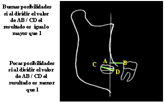 Fig. 4 Según Olive y Basford. Tomado de Quiros-Palma