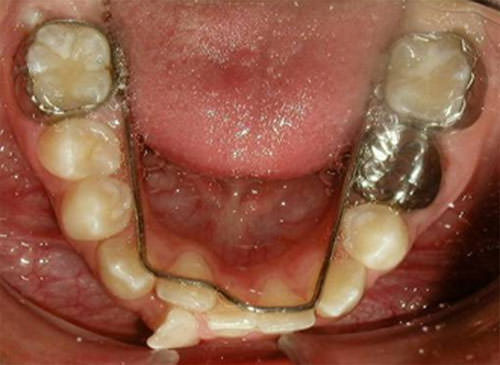 Fig. 9 Fotografía intraoral oclusal inferior