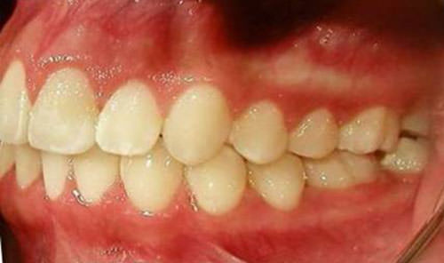 Fig. 24 Fotografía lateral izquierda final