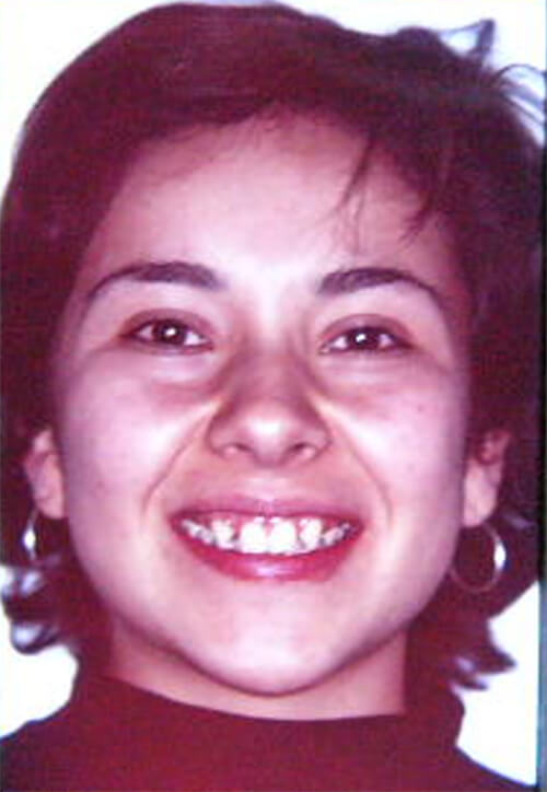 Foto 4 Paciente de frente sonriendo