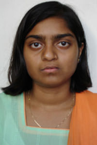 Fig.1 Pre treatment extra oral frontal