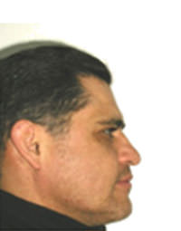 Fig. 3 Fotografía perfil
