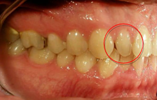 Fig. 6 Fotografía lateral derecha inicial