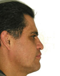 Fig. 11 Fotografía perfil