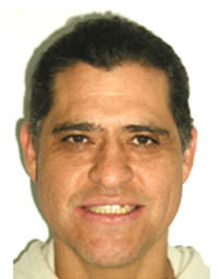 Fig. 20 Fotografía sonrisa