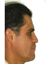 Fig. 21 Fotografía perfil
