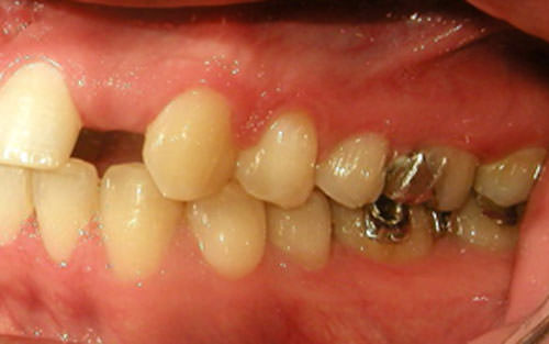 Fig. 24 Fotografía lateral izquierda