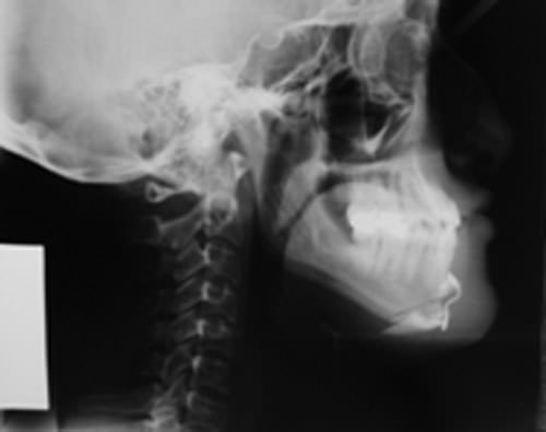 Fig. 3 Fijación interna