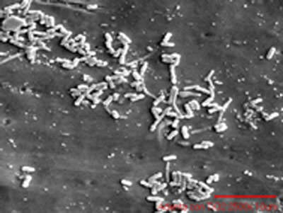 c Fig.1 Photomicrographs showing the extent of bacterial establishment in orthodontic arches "ADenta".,a)arc uncoated, b)arc-coated with TiO2, c) arc witness. 2500X