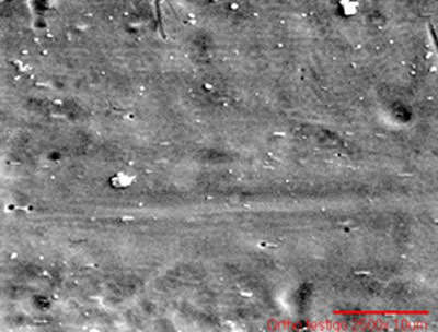 c Fig.4 Photomicrographs showing the extent of bacterial establishment in orthodontic arches. "Ortho". a)arc uncoated, b)arc-coated with TiO2, c) arc witness. 2500X