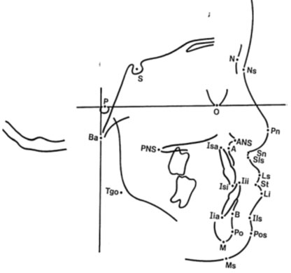Figura 3 Puntos cefalométricos de referencia tomada de un master para paciente del CESO