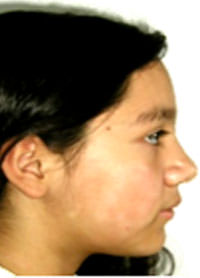 Figura 2
