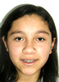Figura 3