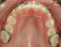 Figura 9