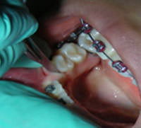 Figura 12