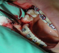 Figura 13