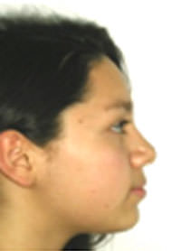 Figura 21