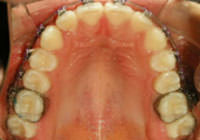 Figura 26