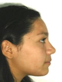 Figura 30 perfil