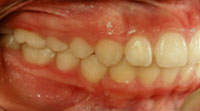 Figura 33
