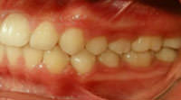 Figura 34