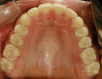 Figura 35