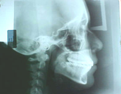 Figura 37