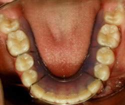 Figura 40