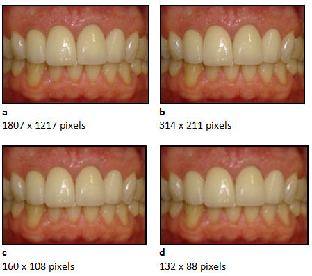 Figure 1 The photographs show the different image resolutions yet with the same dimension (3.7 x 5.42 cm) - (a) 1807 x 1217 pixels; (b) 314 x 211 pixels; (c) 160 x 108 pixels; (d) 132 x 88 pixels. 