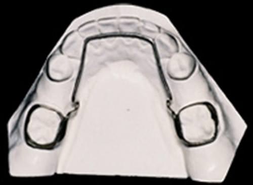 Ejemplo clínico de mantenedor de espacio arco lingual elaborado en el CESO (fig.1)