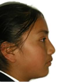 Inicial de perfil (fig. 3)