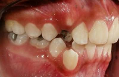 Fotografía Intraoral derecha (fig.6)