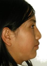 Fotografía de perfil progreso (fig. 11)