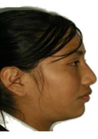 Fotografía de perfil final (fig.18)