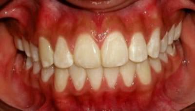 Fotografía Intraoral final (Fig.21)