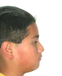 Fig 2 Fotografía de perfil