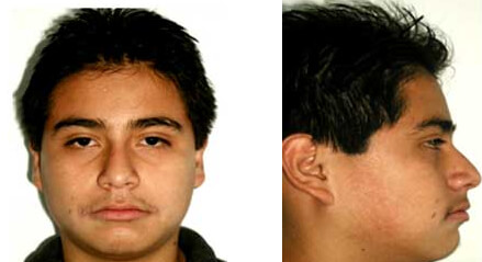 Fig 13 Fotografía de frente y de perfil. Estudios finales.