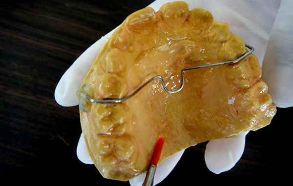 Figure 4 Separating media applied after stabilization of the TPA and before acrylization