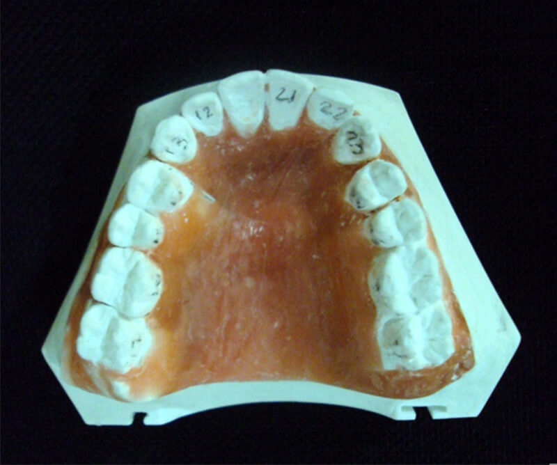 Fig 6 Modelo superior set up