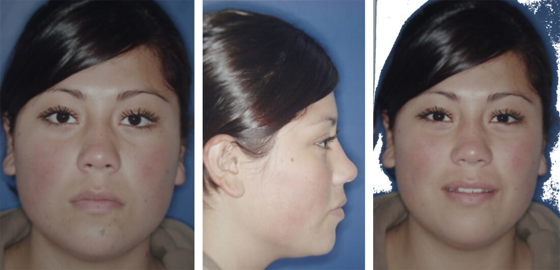Fig 1 Fotografía frente / Fig 2 Fotografía de perfil / Fig 3 Fotografía sonrisa