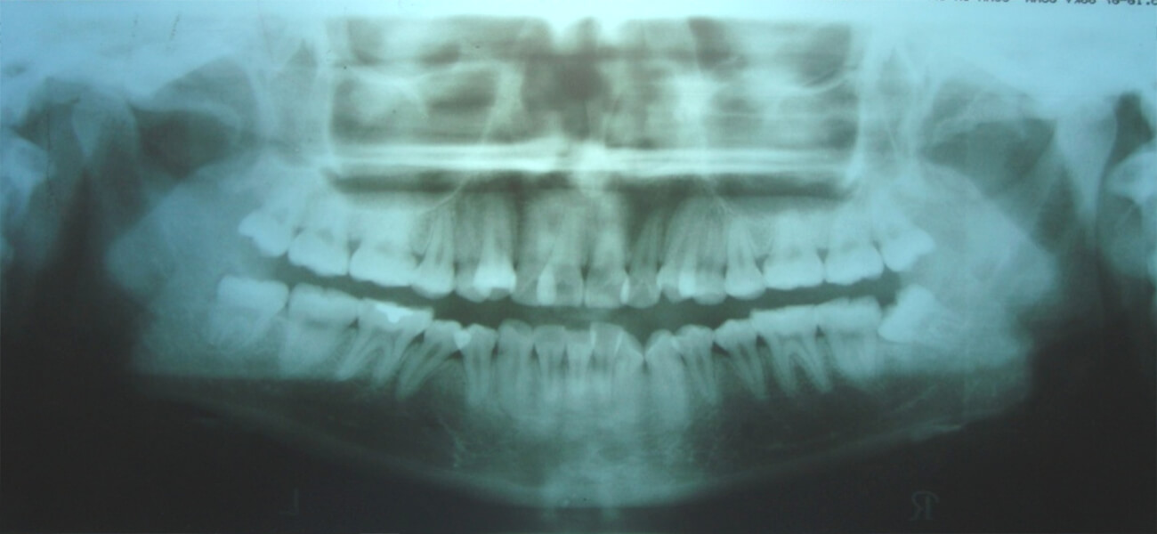 Fig. 5 Rx panorámica de inicio