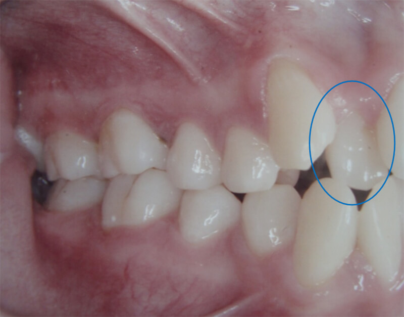 Fig 6 Fotografía lateral derecha inicial