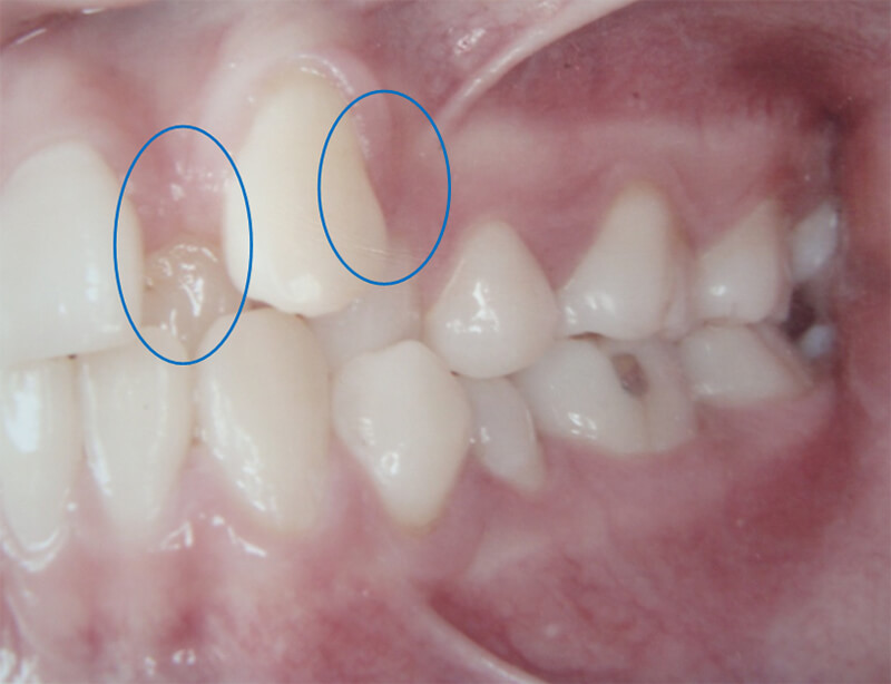 Fig. 7 Fotografía lateral izquierda inicial