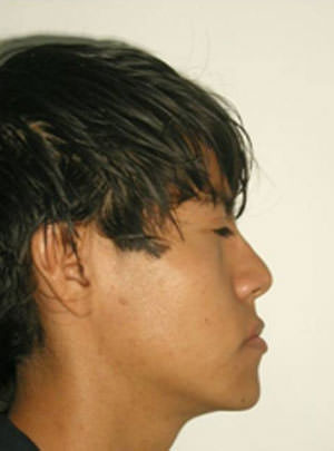 Fig. 2 Fotografía de perfil de inicio
