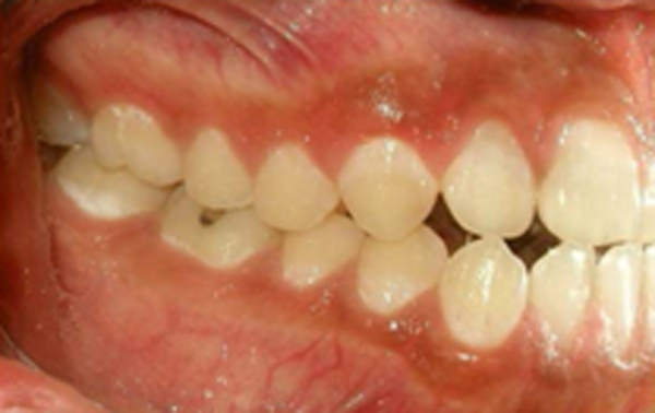 Fig. 5 Fotografía lateral izquierda de inicio