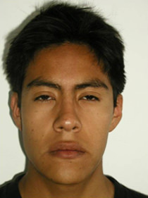 Fig. 11 Fotografía de frente de progreso