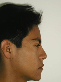 Fig. 12 Perfil de progreso