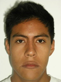 Fig. 21 Fotografía de frente de final
