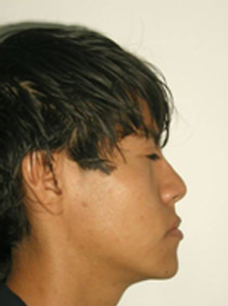 Fig. 22a Perfil de inicio