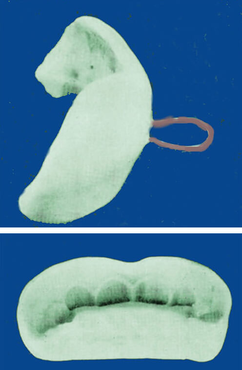 Figura 1 y 2